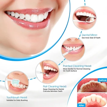 Паста за Зъби за Почистване на Електрическата Четка за Зъби Инструменти За Избелване на устната Кухина Звукова Четка за Зъби Професионално Отстраняване на Зъбни Камъни 4